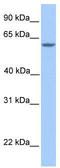 Testis Expressed Metallothionein Like Protein antibody, TA335732, Origene, Western Blot image 