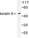 Keratin 8 antibody, LS-C176101, Lifespan Biosciences, Western Blot image 