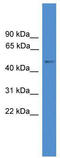 Forkhead box protein C1 antibody, TA335193, Origene, Western Blot image 