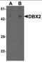 Developing Brain Homeobox 2 antibody, orb137325, Biorbyt, Western Blot image 