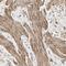 Dihydropyrimidinase Like 3 antibody, HPA010948, Atlas Antibodies, Immunohistochemistry paraffin image 