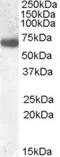 Glucokinase regulatory protein antibody, LS-C112829, Lifespan Biosciences, Western Blot image 