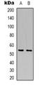 Solute Carrier Family 2 Member 5 antibody, LS-C368951, Lifespan Biosciences, Western Blot image 