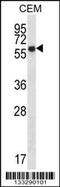 Endoplasmic Reticulum Oxidoreductase 1 Alpha antibody, 56-977, ProSci, Western Blot image 