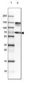 Chromogranin B antibody, PA5-52605, Invitrogen Antibodies, Western Blot image 