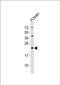 Family With Sequence Similarity 168 Member B antibody, PA5-72218, Invitrogen Antibodies, Western Blot image 