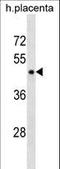 Perilipin 3 antibody, LS-C158682, Lifespan Biosciences, Western Blot image 