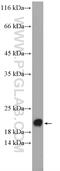 ADP Ribosylation Factor Like GTPase 6 antibody, 12676-1-AP, Proteintech Group, Western Blot image 
