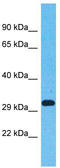 Olfactory Receptor Family 5 Subfamily AN Member 1 antibody, TA337515, Origene, Western Blot image 