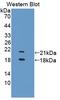 Transient Receptor Potential Cation Channel Subfamily V Member 6 antibody, LS-C727553, Lifespan Biosciences, Western Blot image 
