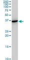 Snail Family Transcriptional Repressor 2 antibody, H00006591-M05, Novus Biologicals, Western Blot image 