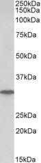 Purine Nucleoside Phosphorylase antibody, LS-B10515, Lifespan Biosciences, Western Blot image 