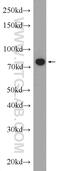 Minichromosome Maintenance Complex Component 7 antibody, 11225-1-AP, Proteintech Group, Western Blot image 