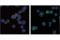 Transmembrane Protein 173 antibody, 43499S, Cell Signaling Technology, Immunocytochemistry image 