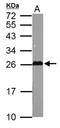 Glutathione S-Transferase Mu 5 antibody, NBP1-32682, Novus Biologicals, Western Blot image 