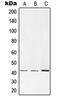 Protein Kinase CAMP-Activated Catalytic Subunit Alpha antibody, MBS821014, MyBioSource, Western Blot image 