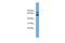 YY1 Associated Protein 1 antibody, PA5-43632, Invitrogen Antibodies, Western Blot image 