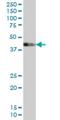 LIM Domain Binding 1 antibody, H00008861-M03, Novus Biologicals, Western Blot image 