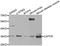Ciliary Neurotrophic Factor Receptor antibody, LS-B14882, Lifespan Biosciences, Western Blot image 