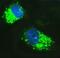 Sequestosome 1 antibody, PA1955, Boster Biological Technology, Immunofluorescence image 