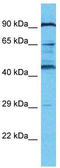 KRAB-A Domain Containing 2 antibody, TA337397, Origene, Western Blot image 