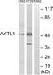 Lysophosphatidylcholine Acyltransferase 2 antibody, PA5-39008, Invitrogen Antibodies, Western Blot image 