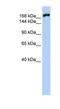 Myosin Heavy Chain 10 antibody, NBP1-55146, Novus Biologicals, Western Blot image 