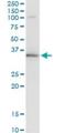 BUD23 RRNA Methyltransferase And Ribosome Maturation Factor antibody, H00114049-M11, Novus Biologicals, Immunoprecipitation image 