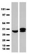 ST13 Hsp70 Interacting Protein antibody, LS-C793798, Lifespan Biosciences, Western Blot image 