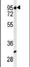 Membrane Metalloendopeptidase antibody, PA5-14214, Invitrogen Antibodies, Western Blot image 