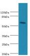 Cryptochrome Circadian Regulator 2 antibody, MBS1497526, MyBioSource, Western Blot image 