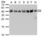 SET Nuclear Proto-Oncogene antibody, NBP1-33713, Novus Biologicals, Western Blot image 