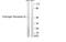 Estrogen Receptor 2 antibody, MBS5300481, MyBioSource, Western Blot image 