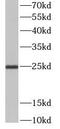 CD9 Molecule antibody, FNab01508, FineTest, Western Blot image 