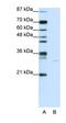 Apoptosis Inducing Factor Mitochondria Associated 1 antibody, orb324833, Biorbyt, Western Blot image 
