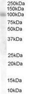 HPS6 Biogenesis Of Lysosomal Organelles Complex 2 Subunit 3 antibody, GTX89591, GeneTex, Western Blot image 