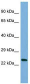 Mannosidase Endo-Alpha Like antibody, TA338665, Origene, Western Blot image 