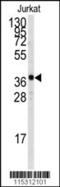 TAL BHLH Transcription Factor 1, Erythroid Differentiation Factor antibody, 61-485, ProSci, Western Blot image 