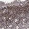 Serum Amyloid A Like 1 antibody, NBP1-83447, Novus Biologicals, Immunohistochemistry frozen image 