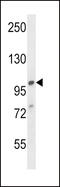 Adaptor Related Protein Complex 2 Subunit Alpha 1 antibody, 57-344, ProSci, Western Blot image 