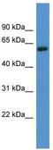 Adrenoceptor Alpha 1B antibody, TA342795, Origene, Western Blot image 