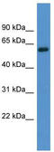 Adrenoceptor Alpha 1B antibody, TA342795, Origene, Western Blot image 