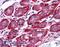 Thyroid Hormone Receptor Alpha antibody, 46-487, ProSci, Enzyme Linked Immunosorbent Assay image 