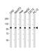 Minichromosome Maintenance Complex Component 3 antibody, M02580-1, Boster Biological Technology, Western Blot image 