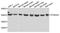 ST8 Alpha-N-Acetyl-Neuraminide Alpha-2,8-Sialyltransferase 2 antibody, A7748, ABclonal Technology, Western Blot image 