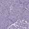 Transducin Beta Like 3 antibody, PA5-60024, Invitrogen Antibodies, Immunohistochemistry paraffin image 