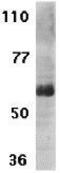 Interleukin 21 Receptor antibody, GTX31271, GeneTex, Western Blot image 