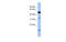 Retinol Dehydrogenase 12 antibody, MBS5301566, MyBioSource, Western Blot image 