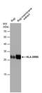 Major Histocompatibility Complex, Class II, DR Beta 5 antibody, PA5-78004, Invitrogen Antibodies, Western Blot image 