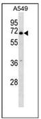 Phospholipase B Domain Containing 2 antibody, AP53330PU-N, Origene, Western Blot image 